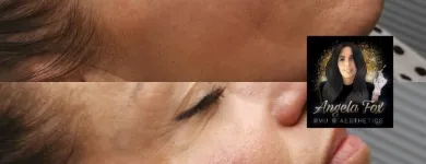 Business 34 image ANGELA FOX PMU & AESTHETICS Plastic & Cosmetic Surgery in Altrincham Ch