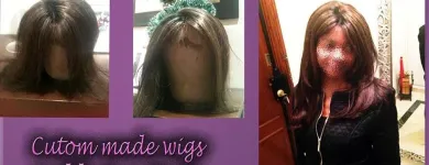 Business 4 image HAIR LOSS LIVERPOOL Wigs & Hairpieces in Liverpool Me