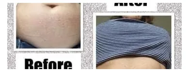 Business 19 image STORM Tanning Salons in Chepstow Gw